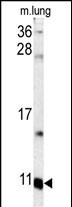 WB - S100A6 Antibody (C-term) AP7346b